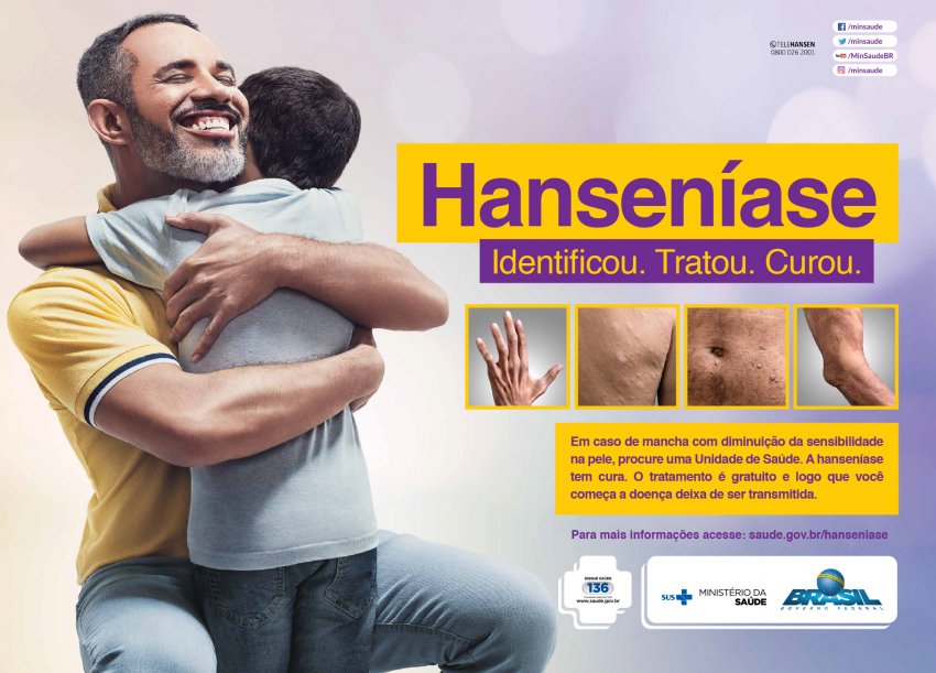 Na região, Chapecó é uma das poucas cidades de SC que oferece um serviço especializado em hanseníase para atendimento dos pacientes
