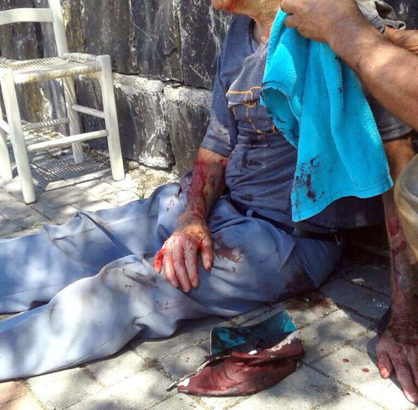 Idoso ficou todo ensanguentado após a ação dos bandidos na manhã desta quarta-feira (13), em Xaxim (Foto: Ronda Policial)